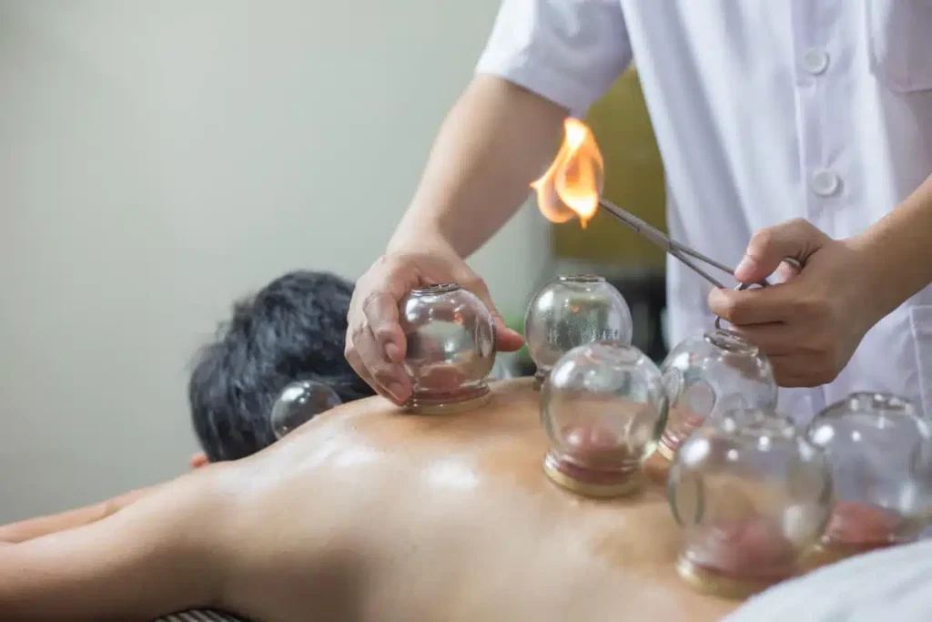Vuur Cupping Hijama Venlo