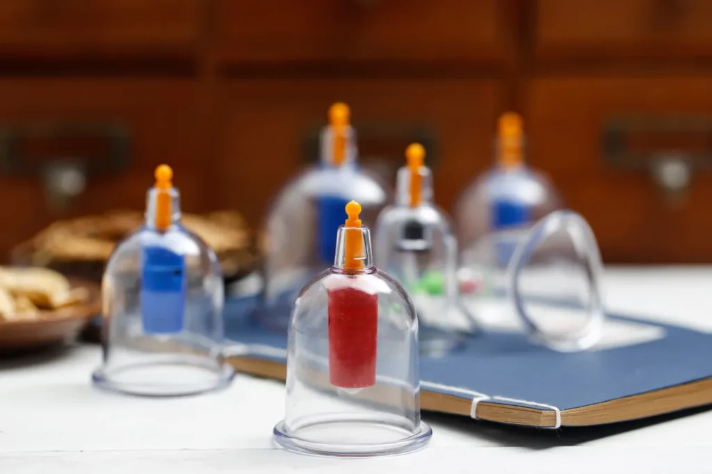 Hijama Cupping Therapie Venlo